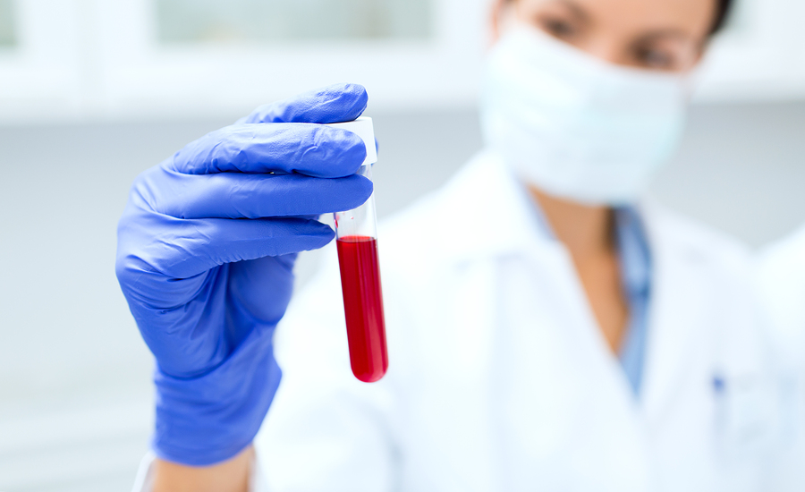 on-site lab services for long-term care